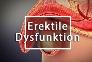 erekt